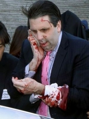 Америкийн элчин сайд өмнөд солонгост халдлагад өртлөө