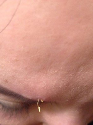 Алтан утас гүйлгэж залуухан болгох биш зүү тавьж хохироожээ