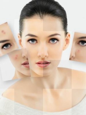 Батга болон батганы соривыг сармисаар ул мөргүй арилгаж болно