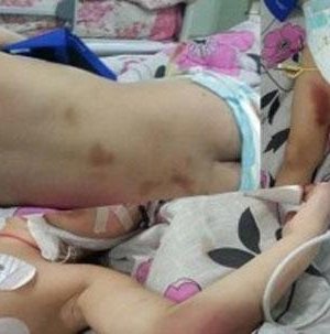 Охиноо алдсан, голсон хоёр эхийн хувь тавилан