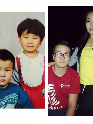 Шүүдэрцэцэг багын зургаа харуулж мэс засал хийлгээгүй гэдгээ хэллээ