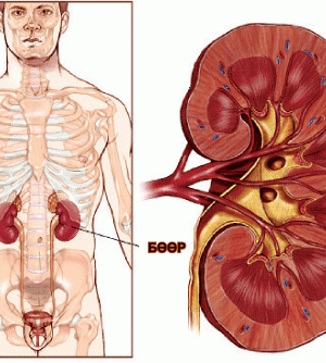 Бөөрний өвчнийг эдгээх монгол арга