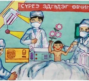 Өнгөрсөн жил 4172 хүн сүрьеэгээр өвджээ