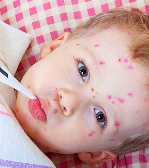 Устсан улаанбурхан улс орноор нь түйвээх нь