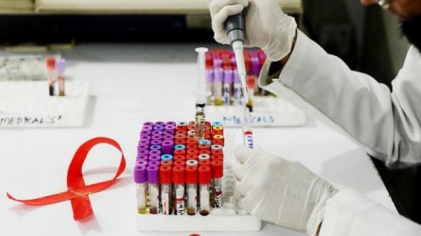 Өмнөд Африкт ХДХВ-ын шинэ вакциныг туршина