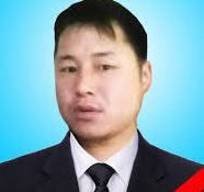 Үл таних этгээдэд бензин цацуулж, ахыгаа хамгаалж түлэгдсэн залуу нас баржээ