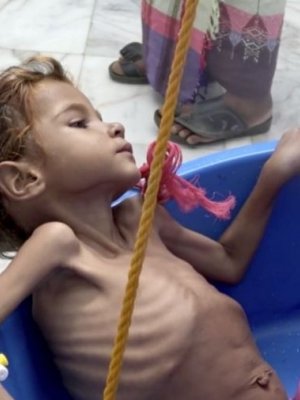 Олон улсын байгууллагууд томоохон компаниудтай хамтран өлсгөлөнтэй тэмцэнэ