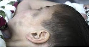 Хойд эцэгтээ зодуулсан хүү гурван хагалгаанд орж, одоогоор ухаангүй байна