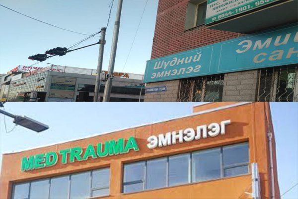 Нэр бүхий эмнэлгүүдийн рентгэн аппаратын ашиглалтын үйл ажиллагааг түр зогсоолоо