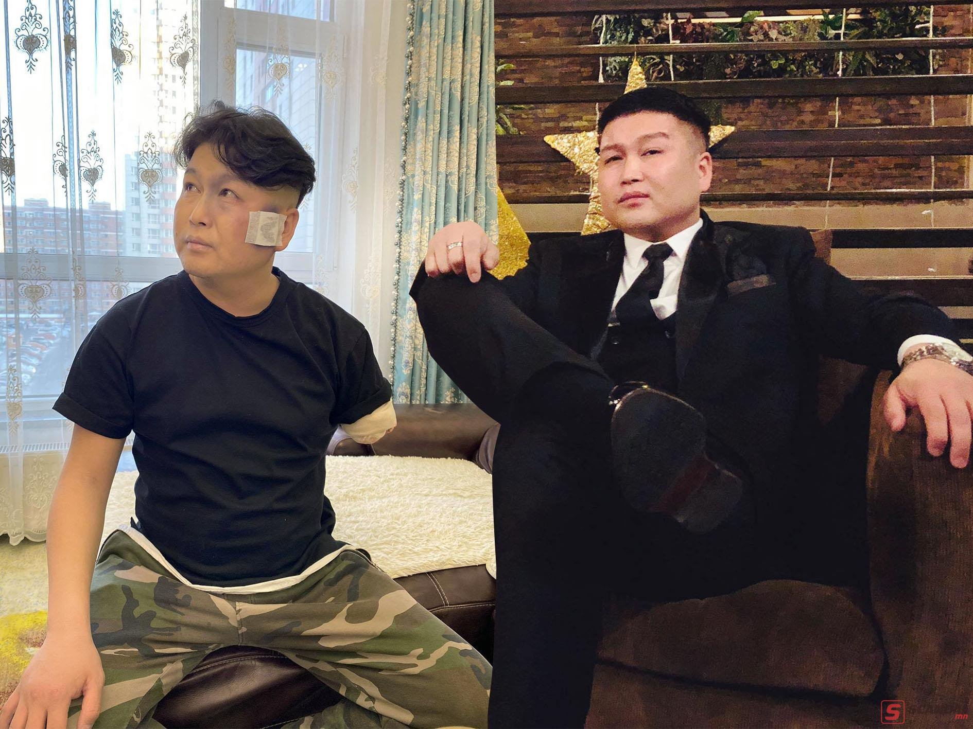 Жүжигчин А.Энхжинд юу тохиолдов?