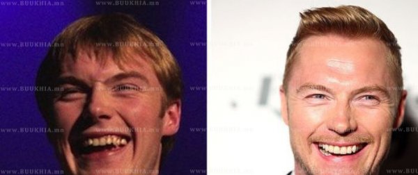 ''Hollywood smile” одуудын өмнө ба одоо