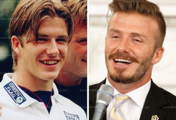 ''Hollywood smile” одуудын өмнө ба одоо
