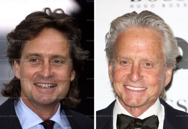 ''Hollywood smile” одуудын өмнө ба одоо