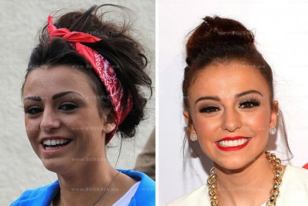 ''Hollywood smile” одуудын өмнө ба одоо