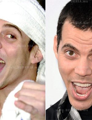 ''Hollywood smile” одуудын өмнө ба одоо