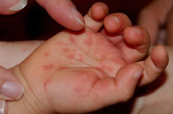 Чимээгүй үхэл буюу хөрсний бохирдолын мөрөөр /сурвалжлага/