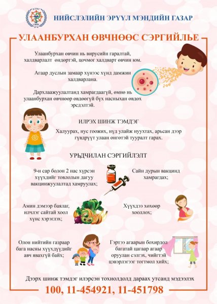 Улаанбурхан өвчний шинж тэмдэг, урьдчилан сэргийлэх зөвлөмж